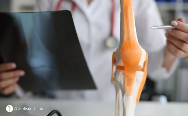 Tendon yaralanması gösteren bir röntgen filmi